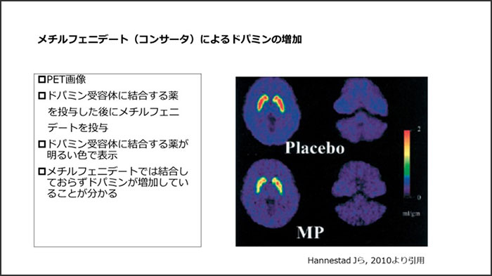 メチルフェニデート（コンサータ）によるドパミンの増加