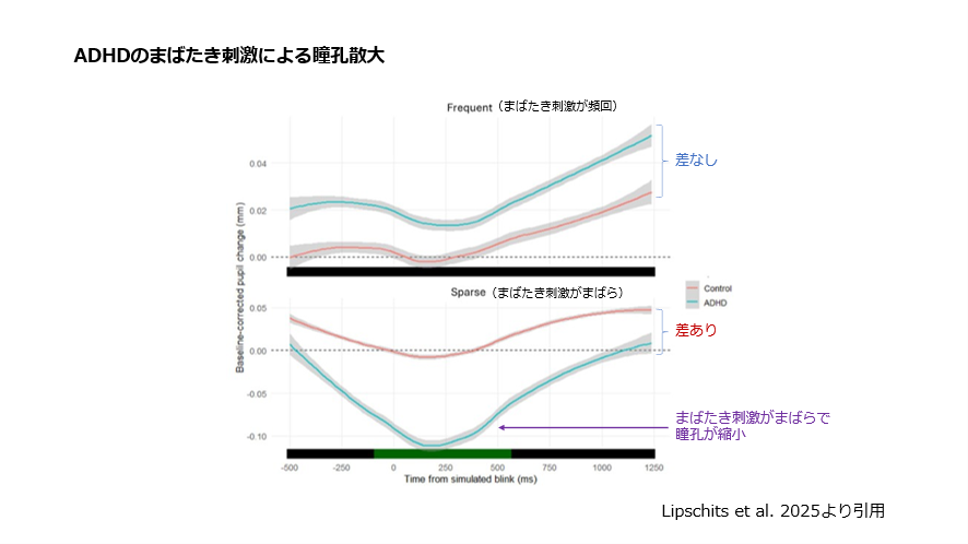 ADHDのまばたき刺激による瞳孔拡大