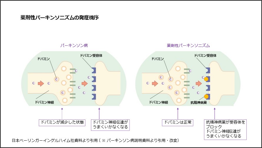 薬剤性パーキンソニズムの発症機序