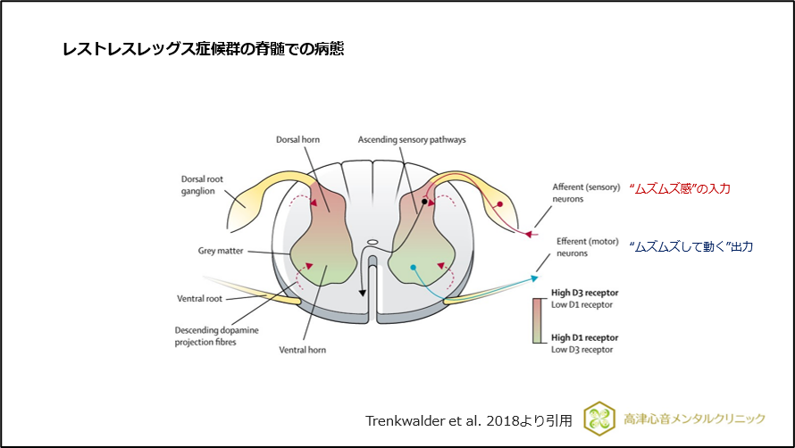 レストレスレッグス症候群の脊髄での病態