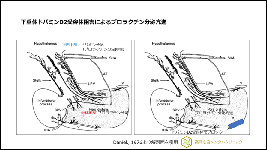 下垂体ドパミンD2受容体阻害によるプロラクチン分泌亢進