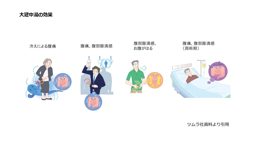 大建中湯の効果