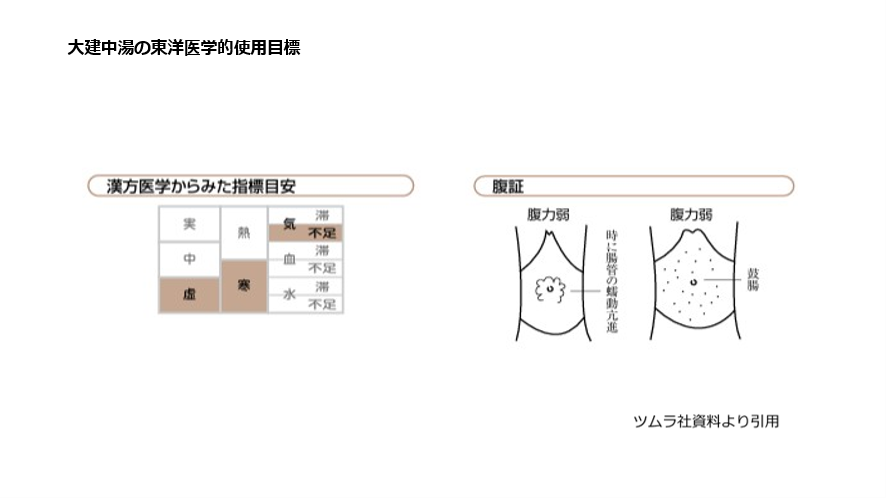 大建中湯の東洋医学的使用目標