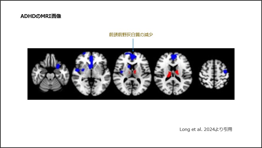 稀で特異な精神症候群ないし状態像 ヨドバシ.com - 稀で特異な精神症候群ないし状態像 [単行本