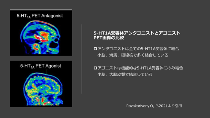 5-HT1A受容体アンタゴニストとアゴニストPET画像の比較