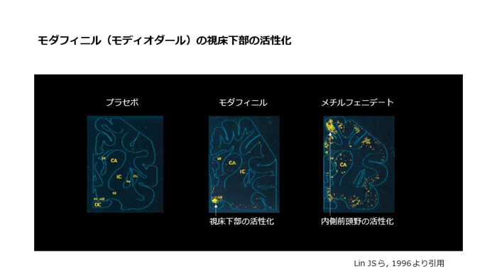 モダフィニル（モディオダール）の視床下部の活性化