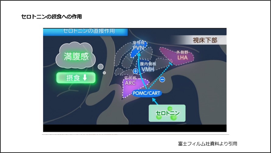 薬と摂食・嚥下障害 作用機序と臨床応用ガイド/Lynette